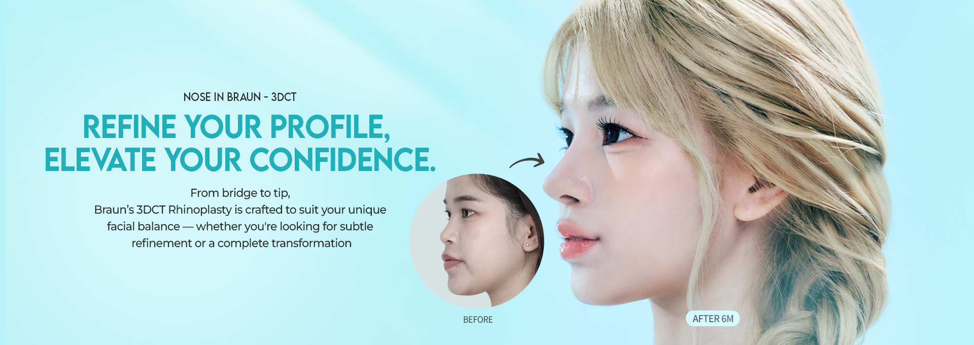 /data/apms/background/BRAUN nose surgery 3DCT before and after results highlighting natural side profile improvement.jpg